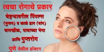 समस्या घेऊन या आणि समाधानी होऊन जा… पुणे येथील त्वचारोग तज्ञ आता जालन्यात देखील उपलब्ध