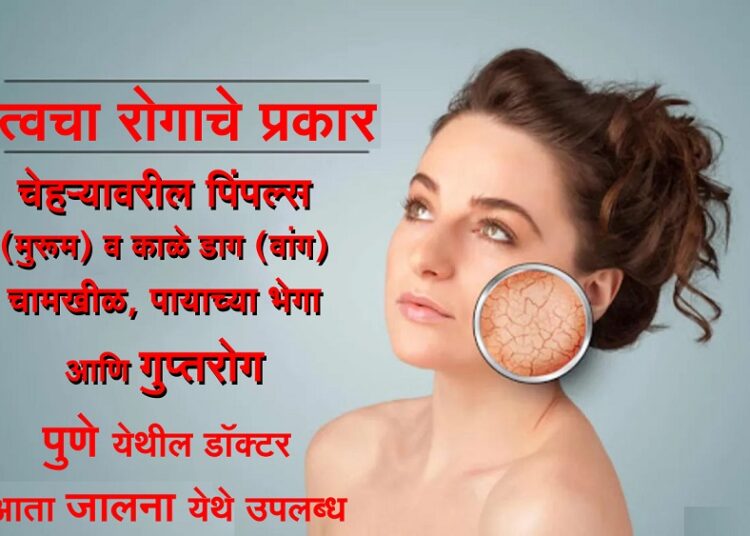 समस्या घेऊन या आणि समाधानी होऊन जा… पुणे येथील त्वचारोग तज्ञ आता जालन्यात देखील उपलब्ध