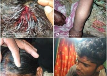 Video – पारेगाव येथे बौध्द कुटुंबीयावर प्राणघातक हल्ला; जखमीवर जिल्हा सामान्य रुग्णालयात उपचार सुरु