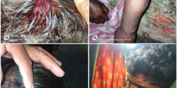 Video – पारेगाव येथे बौध्द कुटुंबीयावर प्राणघातक हल्ला; जखमीवर जिल्हा सामान्य रुग्णालयात उपचार सुरु