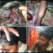 Video – पारेगाव येथे बौध्द कुटुंबीयावर प्राणघातक हल्ला; जखमीवर जिल्हा सामान्य रुग्णालयात उपचार सुरु