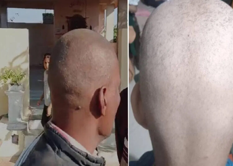 बुलढाण्यातील लोक अचानक टकले का झाले? अखेर झाला उलगडा